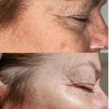 Cargar imagen en el visor de la galería, Vital Eyes 0.5 FL Oz / 15 ml