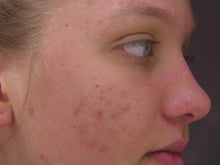 Cargar imagen en el visor de la galería, Clear Rescue - 1 Fl Oz| 30 ml