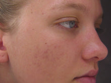 Cargar imagen en el visor de la galería, Clear Rescue - 1 Fl Oz| 30 ml