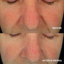 Cargar imagen en el visor de la galería, Soothing Serum - Reparación y alivio del enrojecimiento (1 fl. Oz. E 30ml)