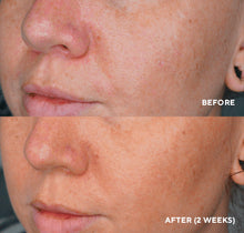 Cargar imagen en el visor de la galería, LUMAPRO C Serum (Corrector de pigmentos para aclarar la piel) 1 FL oz | 30 ml