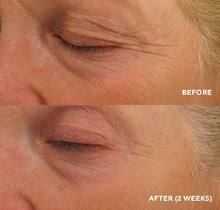 Cargar imagen en el visor de la galería, Eye Authority (Círculos oscuros, bolsas, líneas finas) Tamaño de Viaje 0.17 FL oz | 5ml