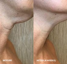 Cargar imagen en el visor de la galería, FIRM-A-FIX NECTAR (Suero Lifting Cuello y Escote) 1.7 FL oz | 50ml