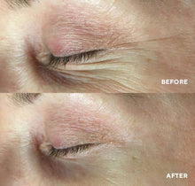 Cargar imagen en el visor de la galería, PolyPeptide Collagel+ Eye (Mascarilla HydroGel para Ojos)