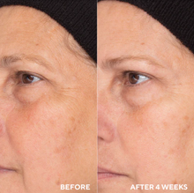 Cargar imagen en el visor de la galería, Retinol Routine Booster (1% Tri-Retinol) 30ml | 1 Fl oz